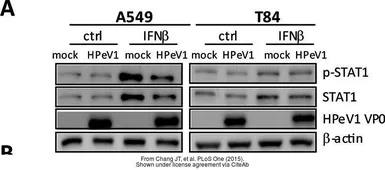 Anti-STAT1 (phospho Tyr701) antibody used in Western Blot (WB). GTX50118