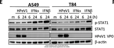 Anti-STAT1 (phospho Tyr701) antibody used in Western Blot (WB). GTX50118