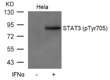 Anti-STAT3 (phospho Tyr705) antibody used in Western Blot (WB). GTX50119