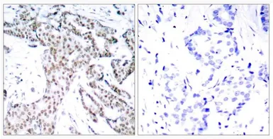 Anti-STAT3 (phospho Ser727) antibody used in IHC (Paraffin sections) (IHC-P). GTX50120