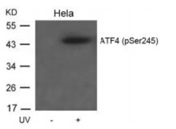 Anti-ATF4 (phospho Ser245) antibody used in Western Blot (WB). GTX50127