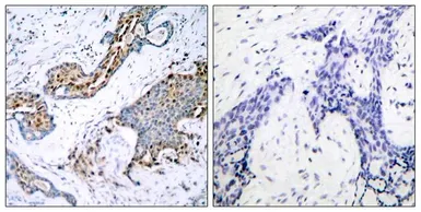 Anti-Estrogen Receptor alpha (phospho Ser118) antibody used in IHC (Paraffin sections) (IHC-P). GTX50139
