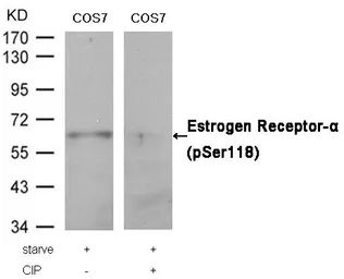 Anti-Estrogen Receptor alpha (phospho Ser118) antibody used in Western Blot (WB). GTX50139