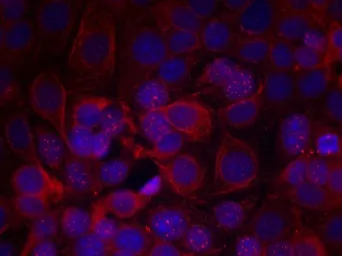 Anti-Her2 / ErbB2 (phospho Tyr1221/Tyr1222) antibody used in Immunocytochemistry/ Immunofluorescence (ICC/IF). GTX50143
