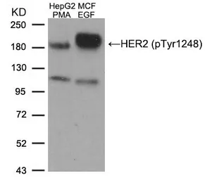 Anti-Her2 / ErbB2 (phospho Tyr1248) antibody used in Western Blot (WB). GTX50146
