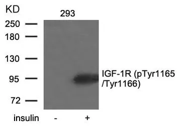 Anti-IGF1R beta (phospho Tyr1135 / Tyr1136) / Insulin Receptor beta (phospho Tyr1150 / Tyr1151) antibody used in Western Blot (WB). GTX50154