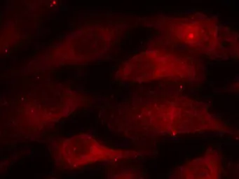Anti-Caveolin 1 (phospho Tyr14) antibody used in Immunocytochemistry/ Immunofluorescence (ICC/IF). GTX50156