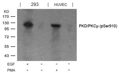 Anti-PKC mu (phospho Ser910) antibody used in Western Blot (WB). GTX50160
