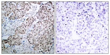 Anti-p53 (phospho Ser315) antibody used in IHC (Paraffin sections) (IHC-P). GTX50164