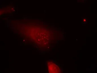 Anti-FOXO1 (phospho Ser319) antibody used in Immunocytochemistry/ Immunofluorescence (ICC/IF). GTX50196