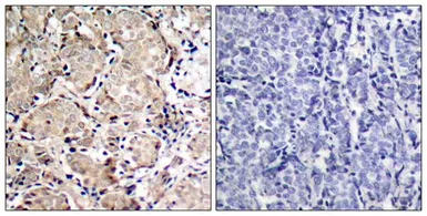 Anti-FOXO1 (phospho Ser319) antibody used in IHC (Paraffin sections) (IHC-P). GTX50196