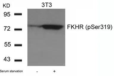 Anti-FOXO1 (phospho Ser319) antibody used in Western Blot (WB). GTX50196