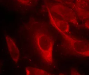 Anti-MEK6 (phospho Ser207) antibody used in Immunocytochemistry/ Immunofluorescence (ICC/IF). GTX50204