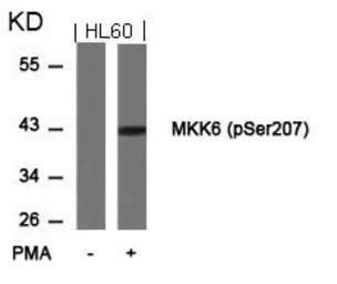 Anti-MEK6 (phospho Ser207) antibody used in Western Blot (WB). GTX50204