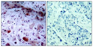 Anti-JAK1 (phospho Tyr1022) antibody used in IHC (Paraffin sections) (IHC-P). GTX50207