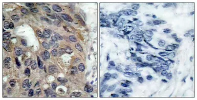 Anti-Src (phospho Tyr530) antibody used in IHC (Paraffin sections) (IHC-P). GTX50210