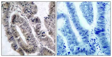 Anti-AMPK alpha 1 (phospho Ser496) antibody used in IHC (Paraffin sections) (IHC-P). GTX50224