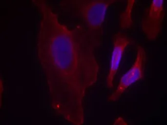 Anti-PLCG2 (phospho Tyr753) antibody used in Immunocytochemistry/ Immunofluorescence (ICC/IF). GTX50225