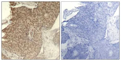 Anti-HDAC2 (phospho Ser394) antibody used in IHC (Paraffin sections) (IHC-P). GTX50236
