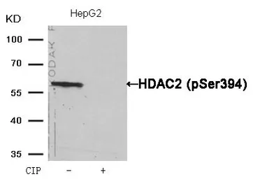 Anti-HDAC2 (phospho Ser394) antibody used in Western Blot (WB). GTX50236