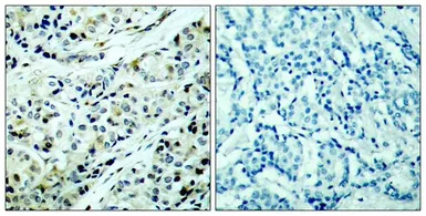 Anti-HDAC5 (phospho Ser498) antibody used in IHC (Paraffin sections) (IHC-P). GTX50238