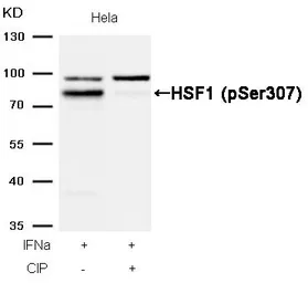 Anti-HSF1 (phospho Ser307) antibody used in Western Blot (WB). GTX50239