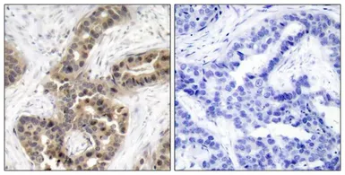 Anti-p21 Cip1 (phospho Thr145) antibody used in IHC (Paraffin sections) (IHC-P). GTX50247