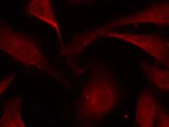 Anti-NFkB p65 (phospho Ser529) antibody used in Immunocytochemistry/ Immunofluorescence (ICC/IF). GTX50254