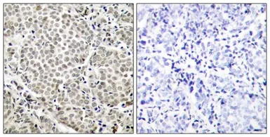 Anti-NFkB p65 (phospho Ser529) antibody used in IHC (Paraffin sections) (IHC-P). GTX50254