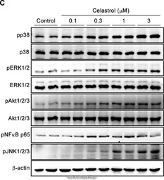 Anti-NFkB p65 (phospho Ser529) antibody used in Western Blot (WB). GTX50254