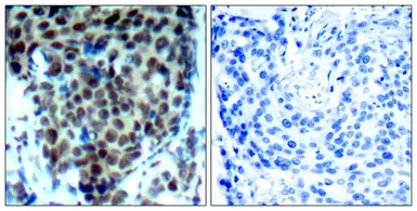Anti-p38 MAPK (phospho Thr180) antibody used in IHC (Paraffin sections) (IHC-P). GTX50280