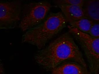 Anti-alpha Synuclein (phospho Tyr125) antibody used in Immunocytochemistry/ Immunofluorescence (ICC/IF). GTX50284