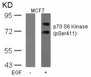 Anti-p70 S6K (phospho Ser411) antibody used in Western Blot (WB). GTX50294