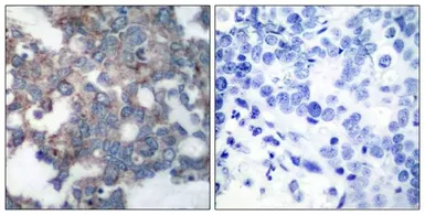 Anti-p70 S6K (phospho Ser424) antibody used in IHC (Paraffin sections) (IHC-P). GTX50304