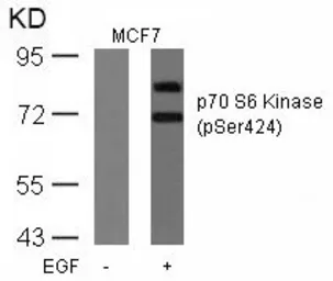Anti-p70 S6K (phospho Ser424) antibody used in Western Blot (WB). GTX50304
