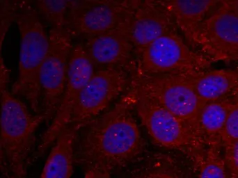 Anti-alpha Synuclein (phospho Tyr136) antibody used in Immunocytochemistry/ Immunofluorescence (ICC/IF). GTX50306