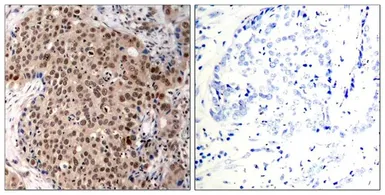 Anti-MAPKAPK-2 (phospho Thr334) antibody used in IHC (Paraffin sections) (IHC-P). GTX50321