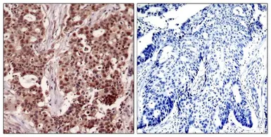 Anti-NFkB p105 (phospho Ser927) antibody used in IHC (Paraffin sections) (IHC-P). GTX50324