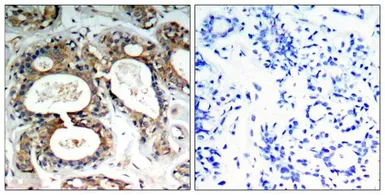 Anti-SHP2 (phospho Tyr542) antibody used in IHC (Paraffin sections) (IHC-P). GTX50328