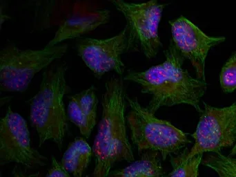 Anti-AKT (phospho Thr450) antibody used in Immunocytochemistry/ Immunofluorescence (ICC/IF). GTX50339