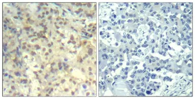 Anti-Cofilin 1 (phospho Tyr140) antibody used in IHC (Paraffin sections) (IHC-P). GTX50340