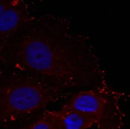 Anti-Paxillin (phospho Tyr88) antibody used in Immunocytochemistry/ Immunofluorescence (ICC/IF). GTX50350