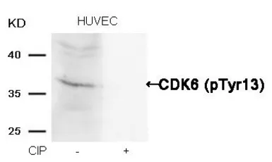 Anti-CDK6 (Phospho Tyr13) antibody used in Western Blot (WB). GTX50352