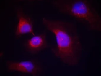 Anti-Syk (phospho Tyr323) antibody used in Immunocytochemistry/ Immunofluorescence (ICC/IF). GTX50355