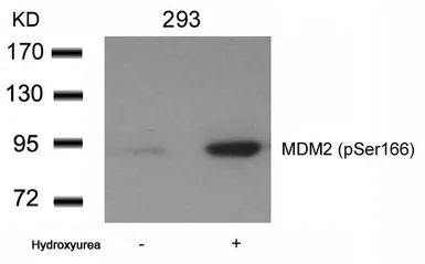 Anti-MDM2 (phospho Ser166) antibody used in Western Blot (WB). GTX50357