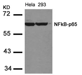 Anti-NFkB p65 antibody used in Western Blot (WB). GTX50374