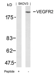 Anti-VEGF Receptor 2 antibody used in Western Blot (WB). GTX50432