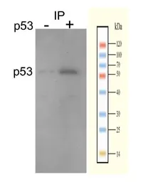 Anti-p53 antibody used in Immunoprecipitation (IP). GTX50438