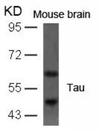 Anti-Tau antibody used in Western Blot (WB). GTX50445