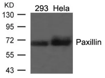 Anti-Paxillin antibody used in Western Blot (WB). GTX50457